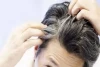 ۱۳ راهکار ساده برای از بین بردن چربی موی سر